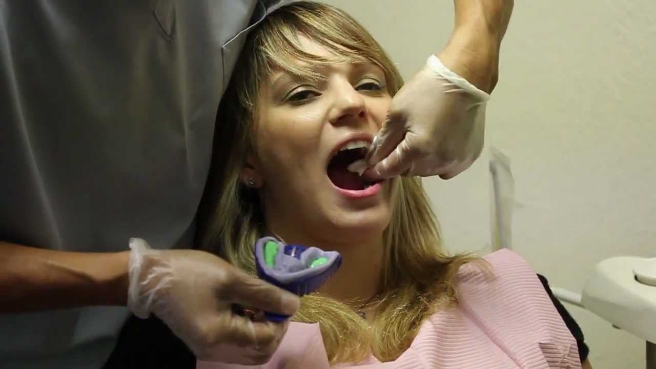 Invisalign Video Blog [HD] - Sierra 02