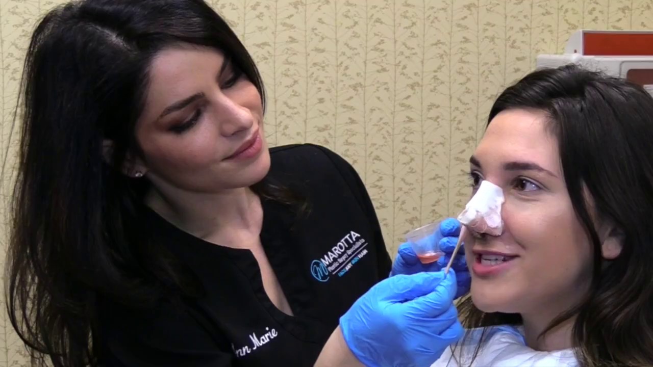 Rhinoplasty Cast Removal: Rapid Recovery Program TM at Marotta Plastic Surgery Specialists