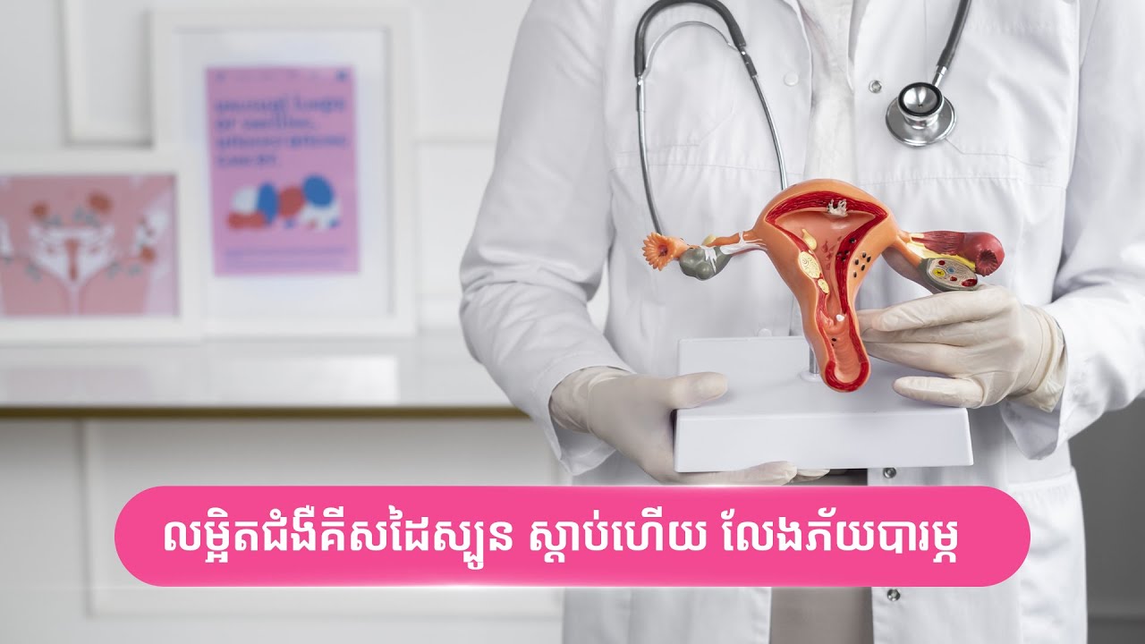 លម្អិតជំងឺគីសដៃស្បូន ស្ដាប់ហើយ លែងភ័យបារម្ភ