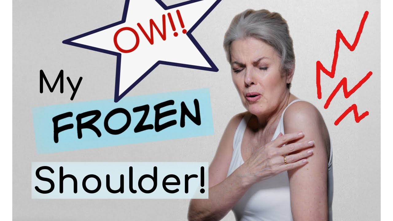 MY FROZEN SHOULDER JOURNEY -  Symptoms, Causes, Diagnosis, Treatment - What's working, what didn't!