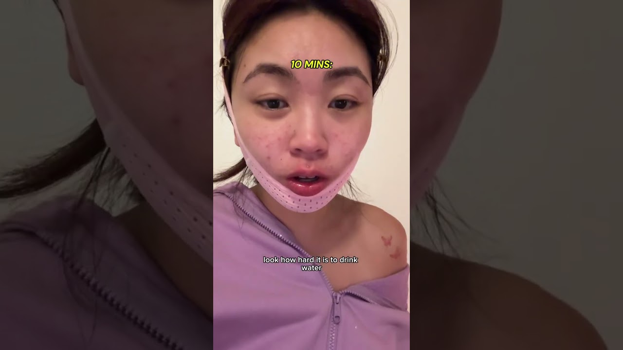 Are chin straps worth it?