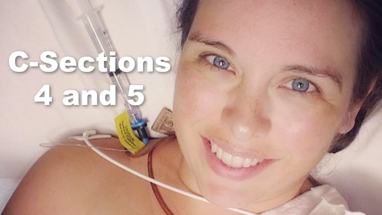 The 4th & 5th C-sections: 2 Birth Stories
