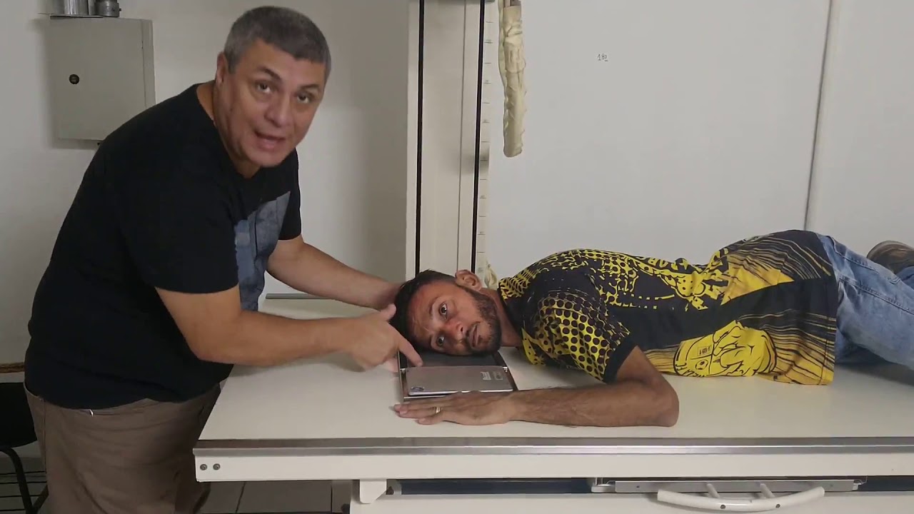 PROTOCOLO DE OSSOS DA FACE - OSSO NASAL PERFIL