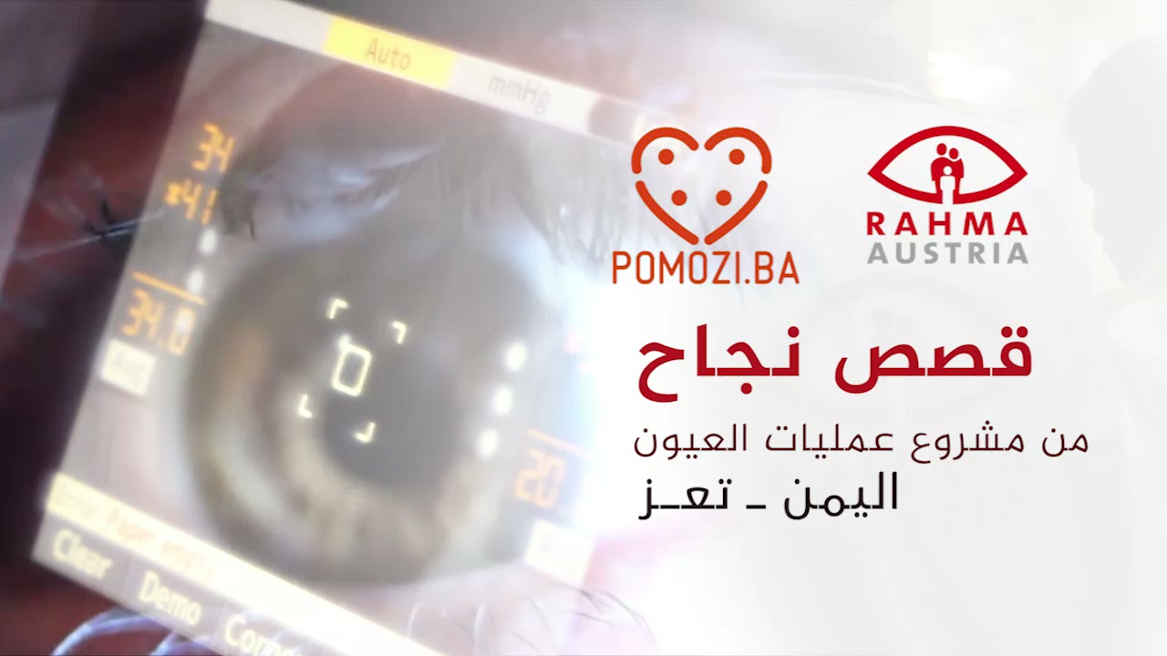قصص نجاح .. مشروع عمليات العيون 01