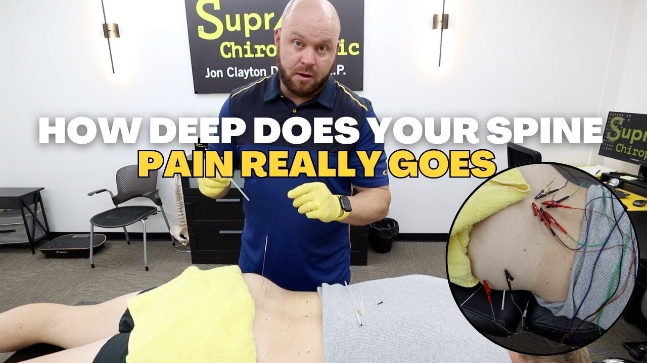 Хиропрактик выявит истинную причину вашей боли в позвоночнике.