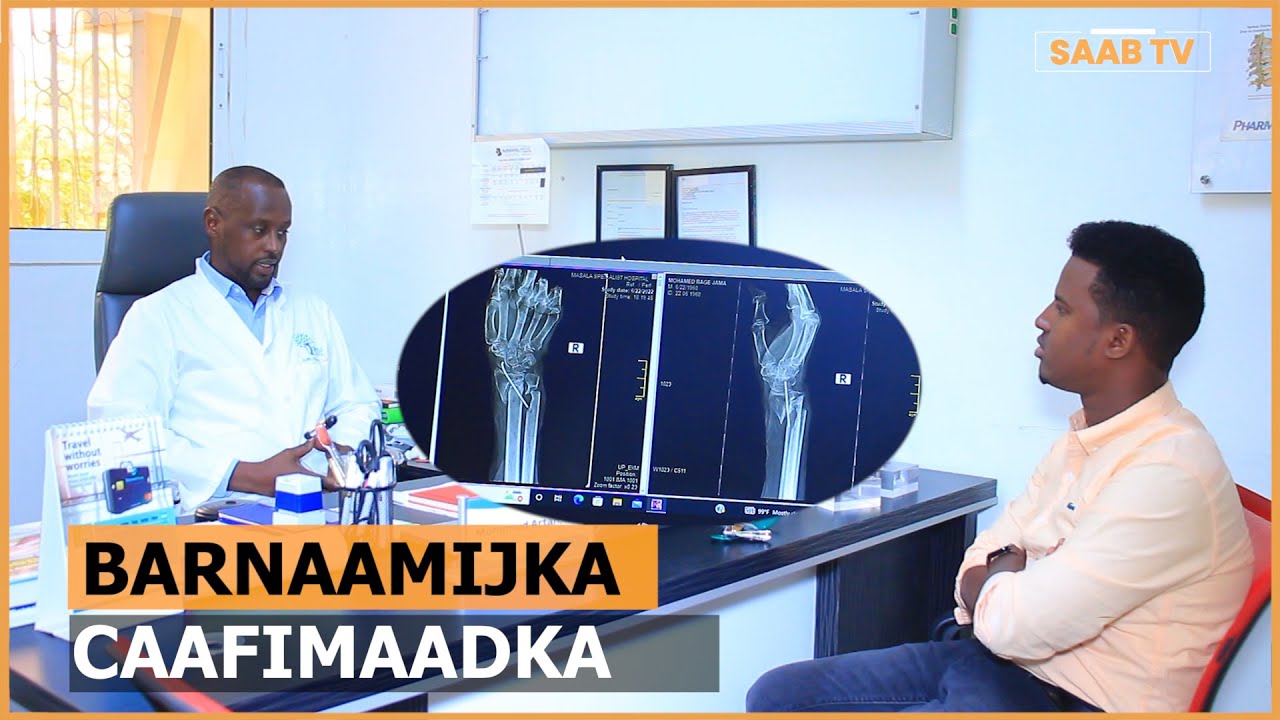 Daaweynta Xanuunada Lafaha iyo dhibaatooyinka ka dhalata dadka sida khaldan kabniinka loogu sameeyo