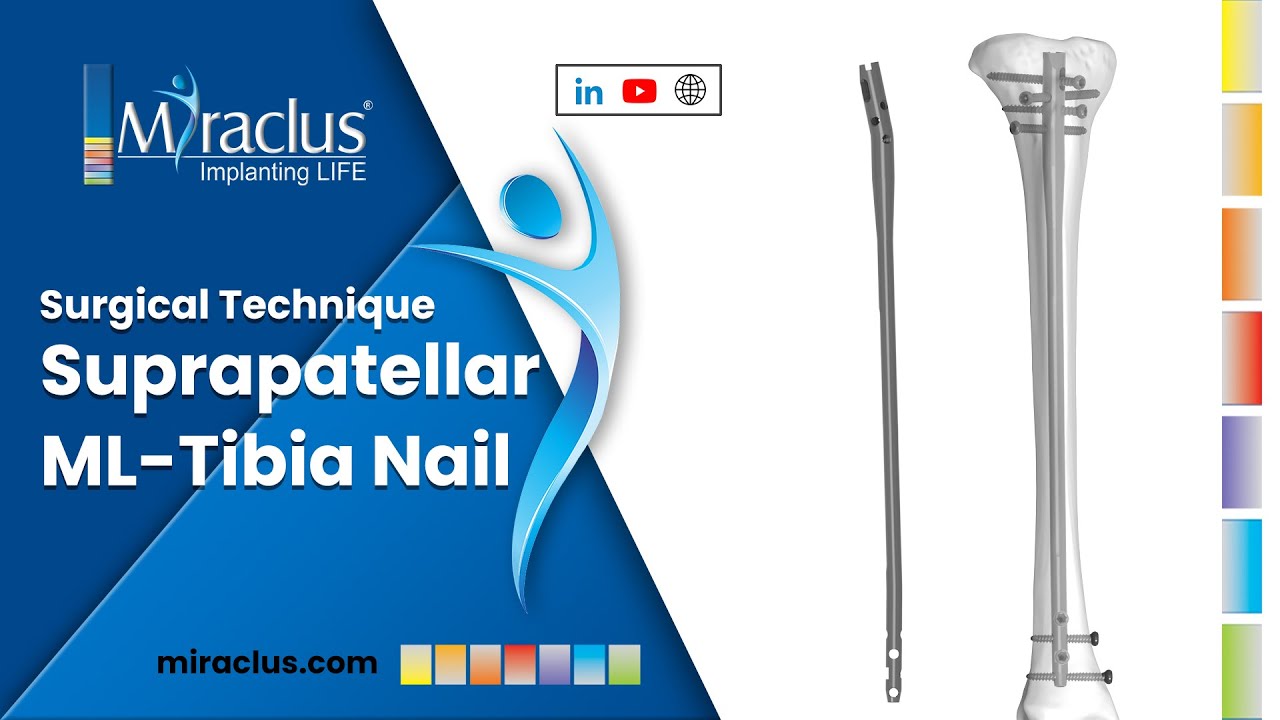 Suprapatellar ML Tibia Nail Surgical Technique