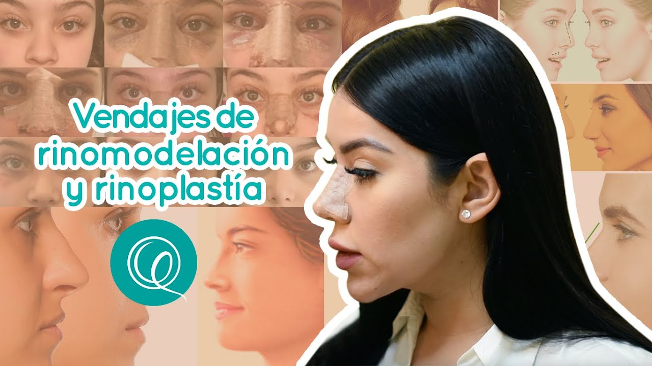 ¡Vendaje de rinomodelación y rinoplastía! - Dra Génesis Quintero