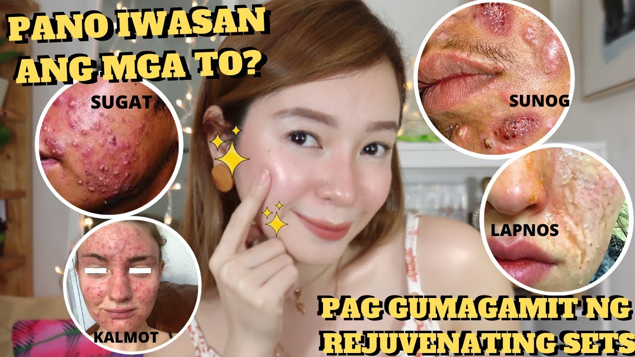 Mga DAPAT IWASAN Pag GUMAGAMiT ng REJUVENATiNG SET! Para iwas Sunog ang MUKHA atbp!