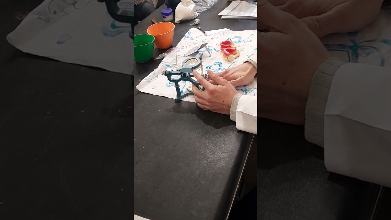 تركيب المثال الجبسي على المطبق  _Installing the gypsum model  on the articular. 1