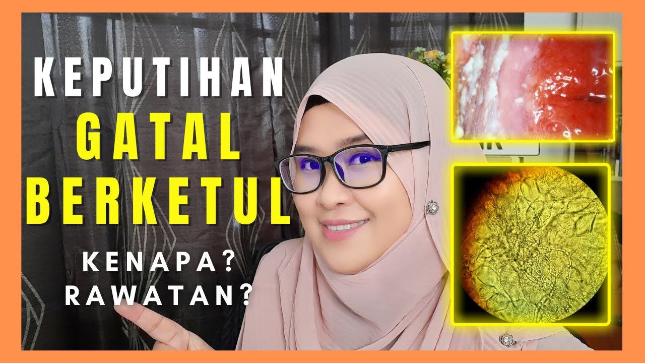 KEPUTIHAN BERKETUL SEPERTI KRIM & KEPUTIHAN GATAL! Kenapa? Cara Merawat & Hilangkan Keputihan Gatal?