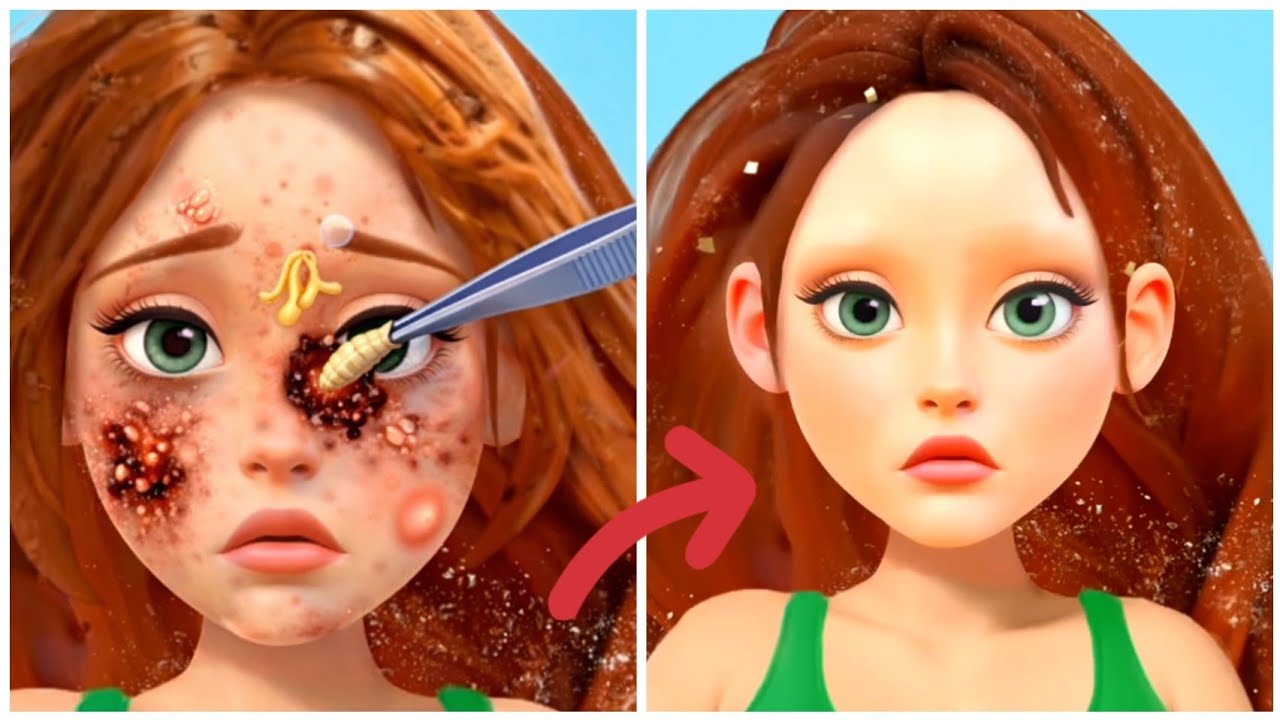 Chapter 10 | Facial Acne Removal & Skin Care Transformation 💆‍♀️✨