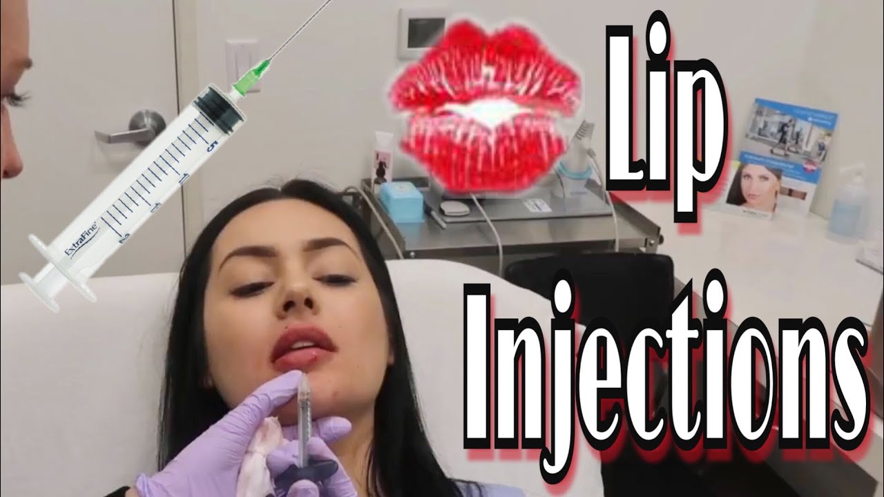 LIP INJECTIONS | VLOG 💋💋💋