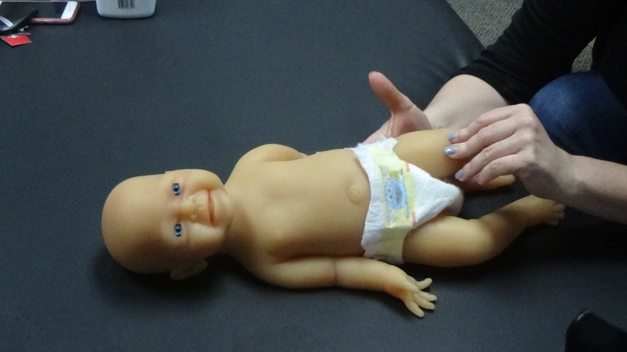 Atypical Development Baby Clubfeet Exercise