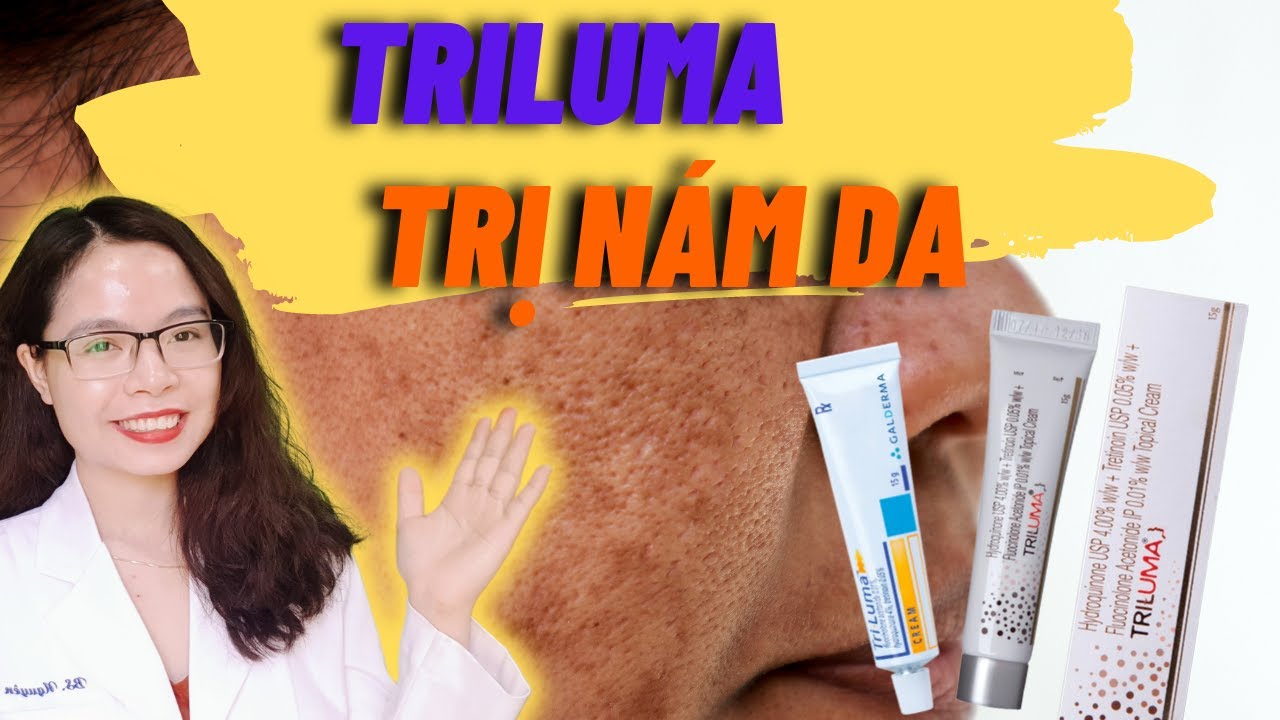 8 Lưu ý quan trọng để dùng triluma trị nám hiệu quả tại nhà - Bác sĩ Nguyên