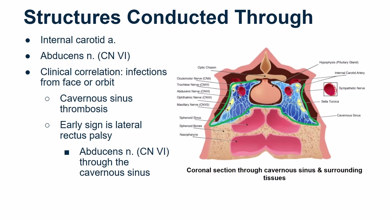 Cavernous Sinus