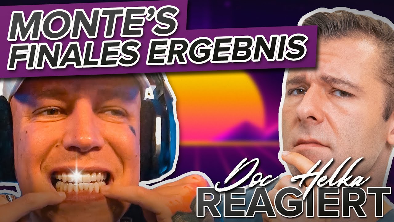 Endergebnis: Montanablack's fertige Zähne! Veneers + Kronen - Reaktion von Doc Helka | Teil 2