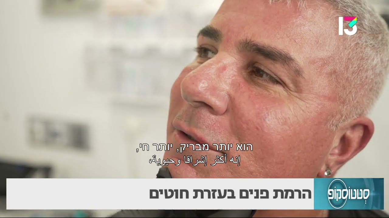 הרמת פנים בעזרת חוטים- ד