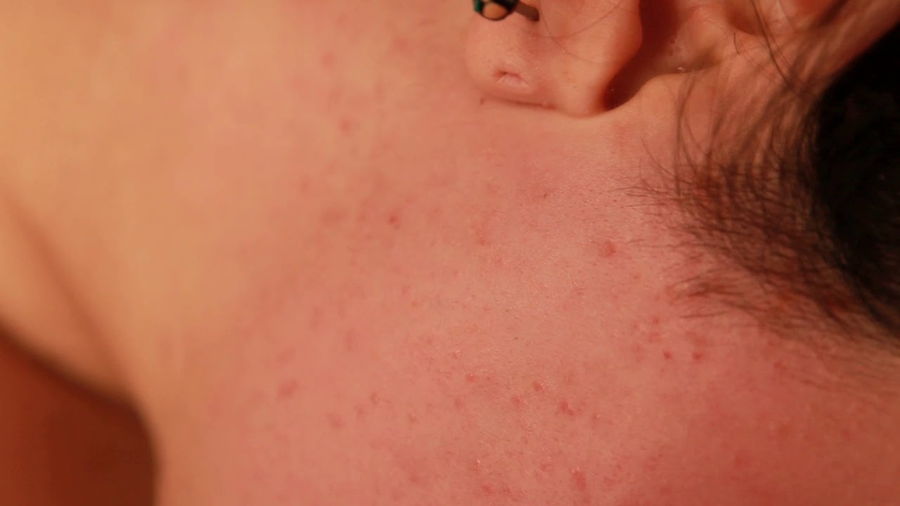 Corso di Estetica - Video Tutorial 4:  Depilazione con filo arabo