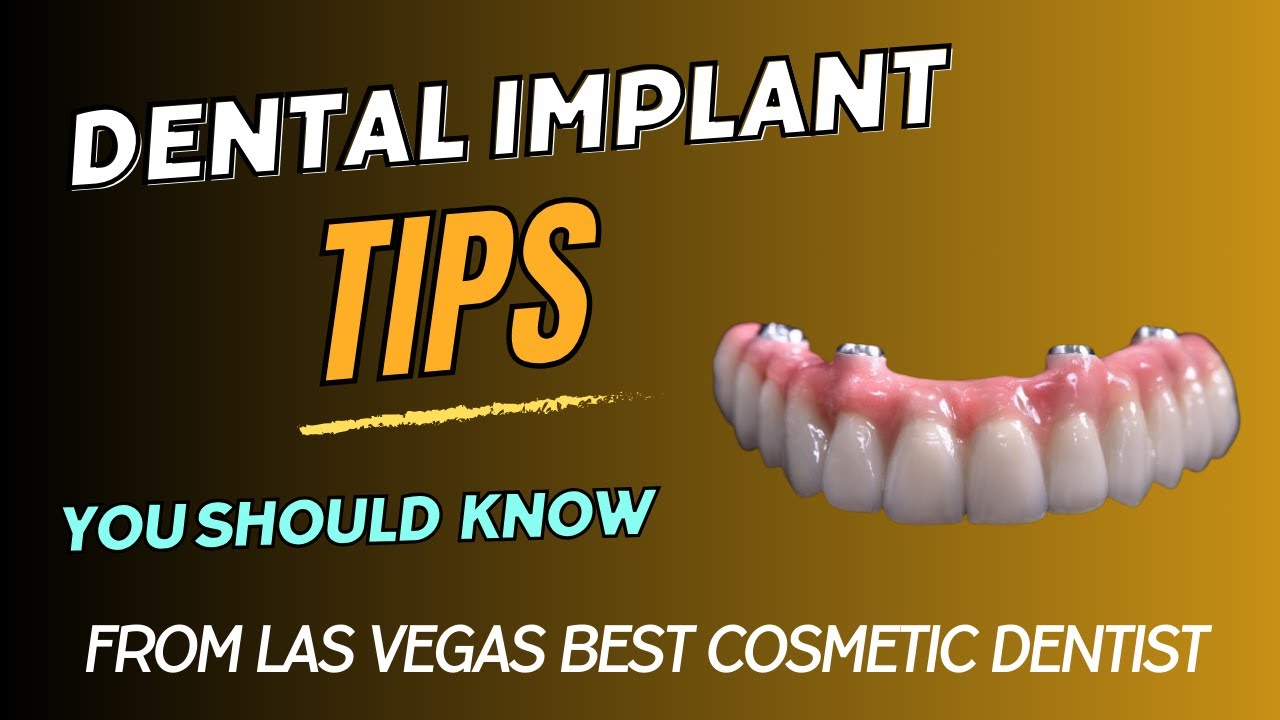 Cosmetic dentists for dental implants in Las Vegas - 702-710-7870- Las Vegas Dental Implants Dentist
