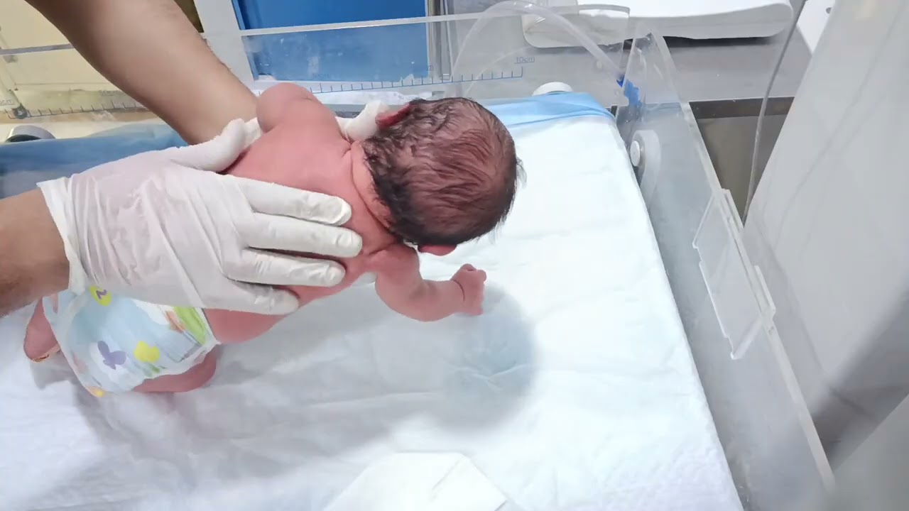 Day_48 baby treatment🩺😷.!#aiims#nicu#hospital#medicallife#newbornbaby#cutebaby#treatment#shortsfeed