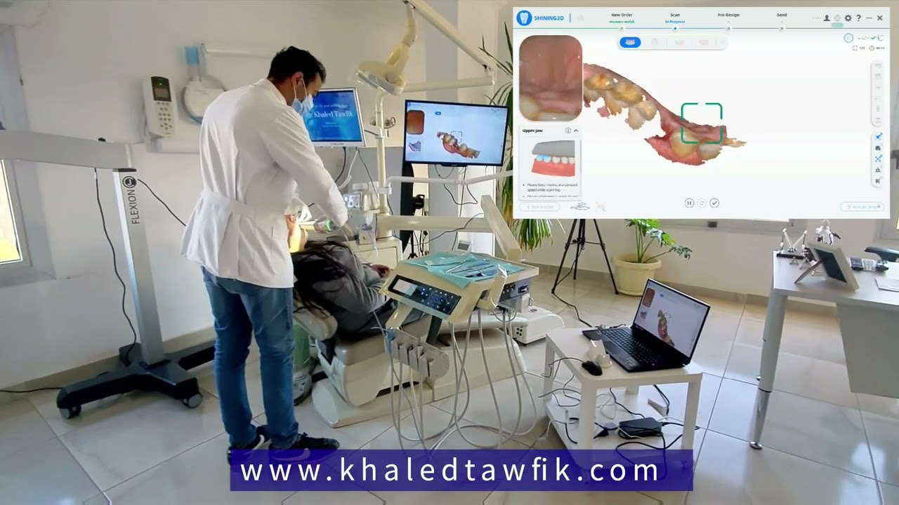 استخدام الماسح الضوئي في مقاسات الاسنان