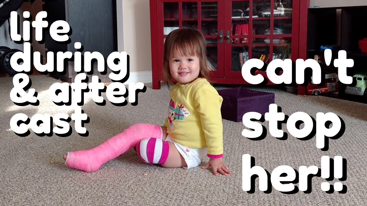 Toddler Broken Leg, Cast, & Recovery (cute 7 week summary)