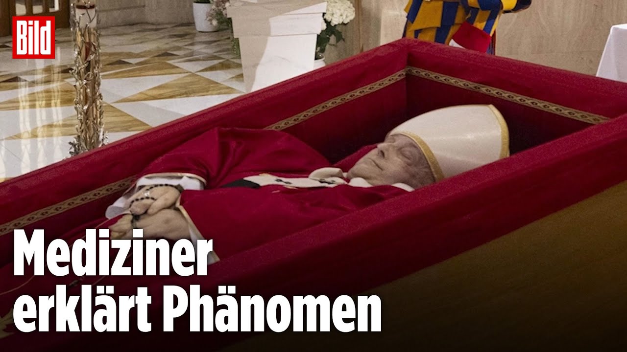 Papst hat nach Tod dunkle Flecken im Gesicht