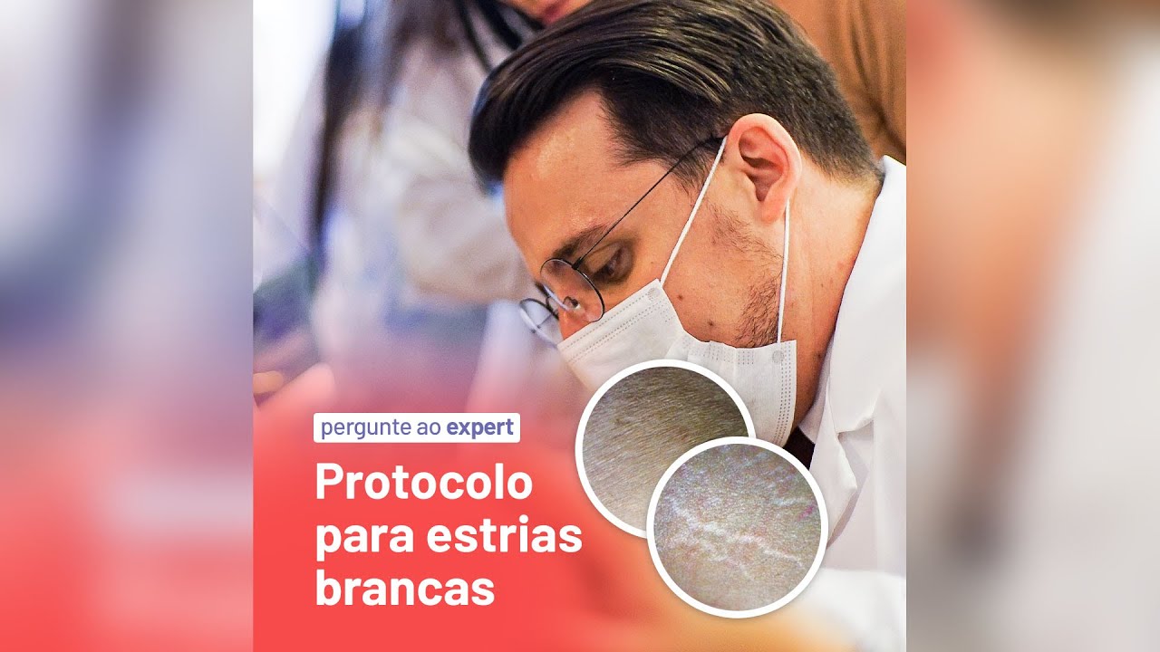 Como montar um protocolo para estrias brancas? - Pergunte #103
