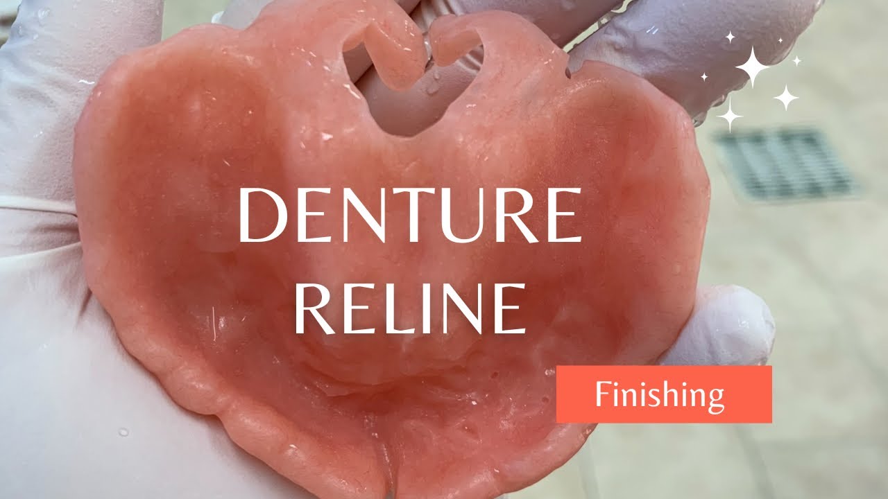 Permanent Denture Relines