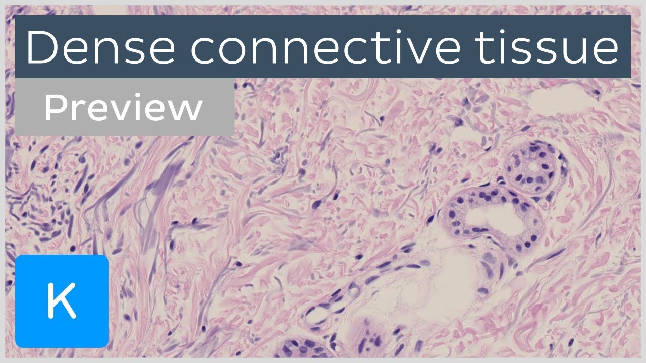 Dense connective tissue: types and function (preview) - Human Histology |&nbsp;Kenhub