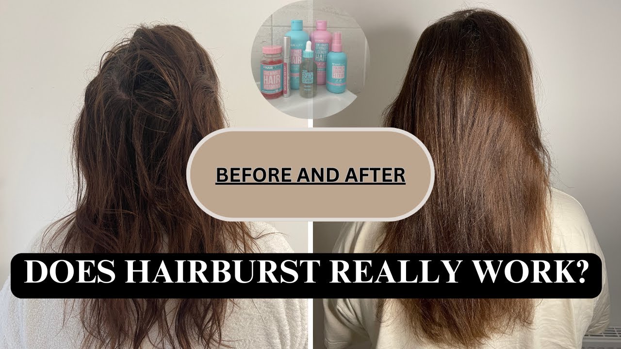 DOSE HAIRBURST ДЕЙСТВИТЕЛЬНО РАБОТАЕТ? До и после | мой отзыв
