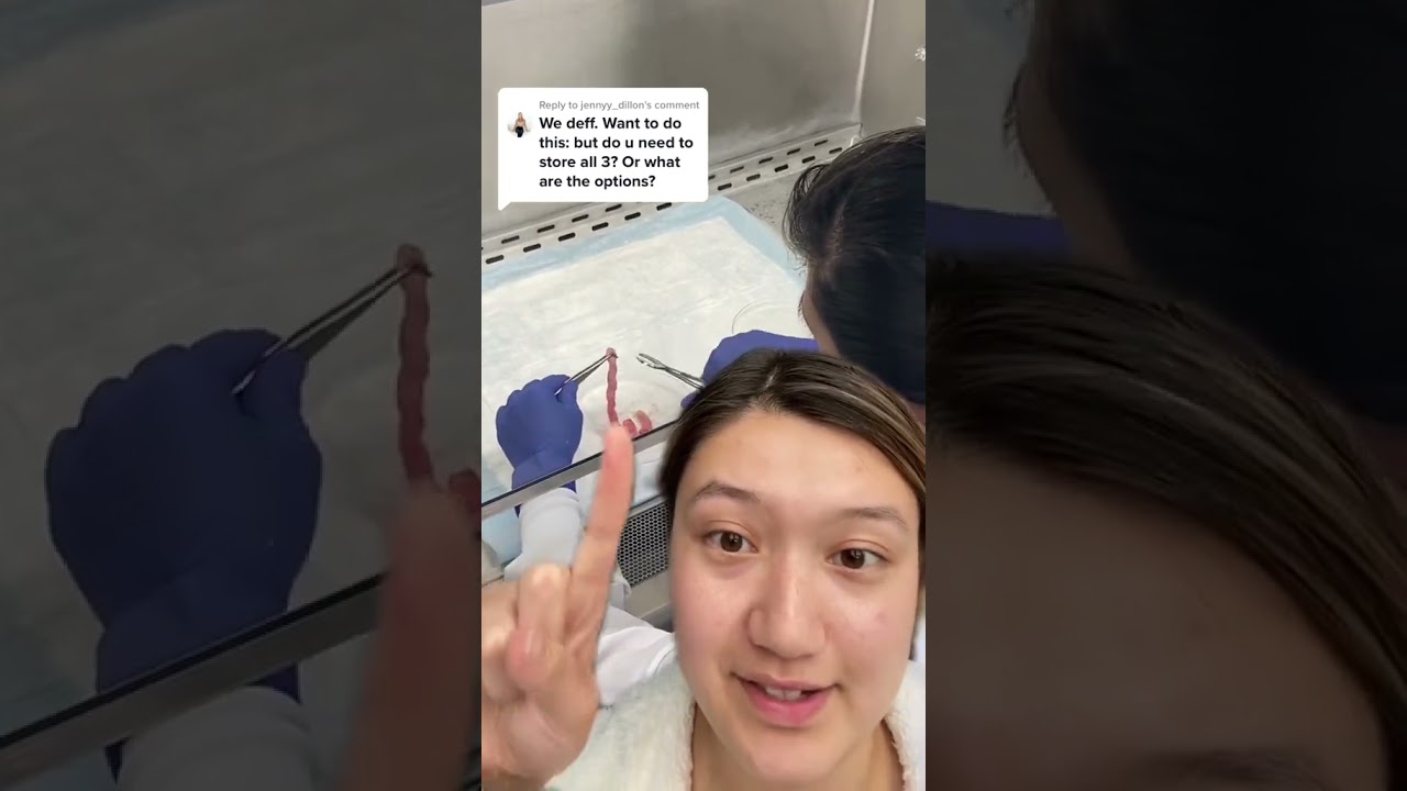 What are your options for freezing stem cells?