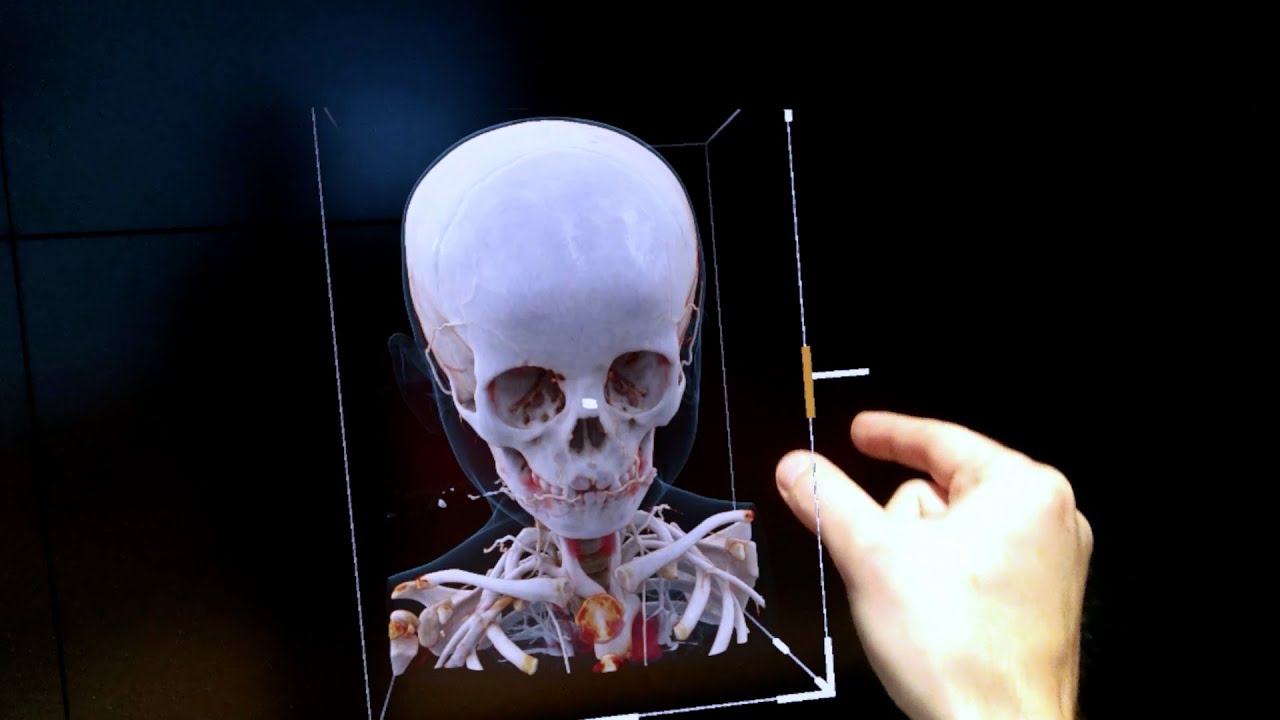 Making the impossible possible: Meet the team who brought Cinematic Rendering to the HoloLens