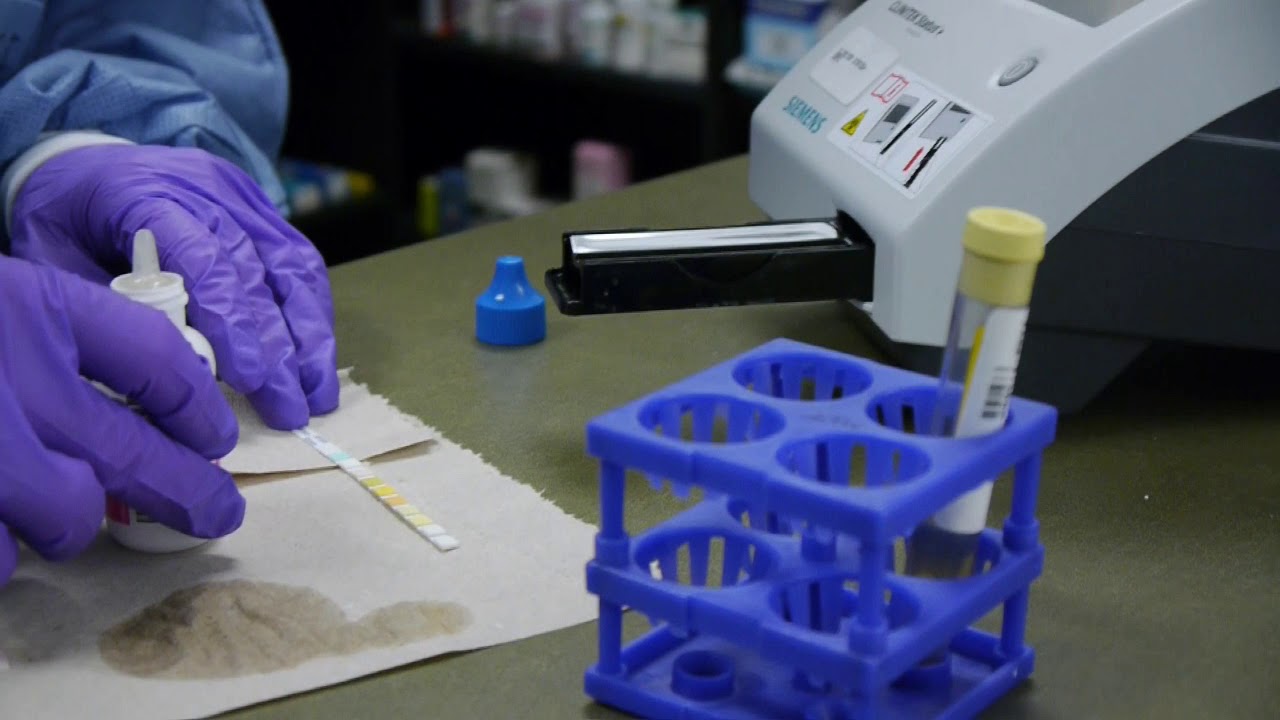 Complete Urinalysis