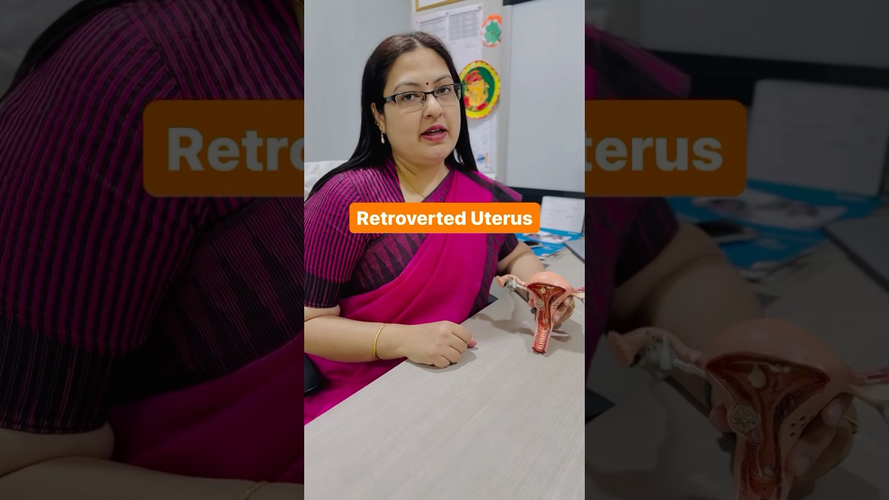 Is a Retroverted Uterus Normal? The Truth No One Shares!