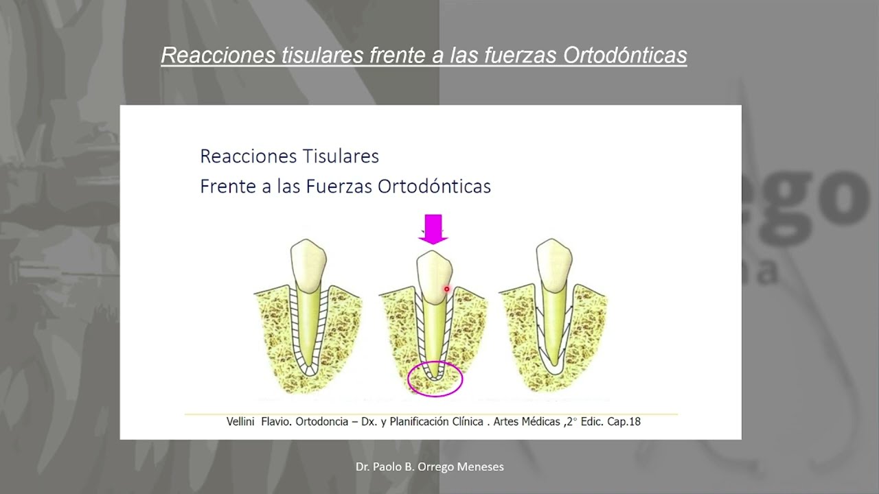 Fisiología del movimiento dentario en Ortodoncia