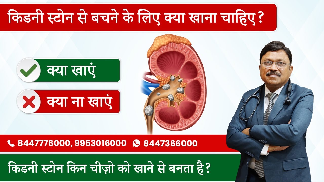 किडनी स्टोन से बचने के लिए क्या खाना चाहिए? | Foods to eat and avoid | Dr. Bimal Chhajer | SAAOL