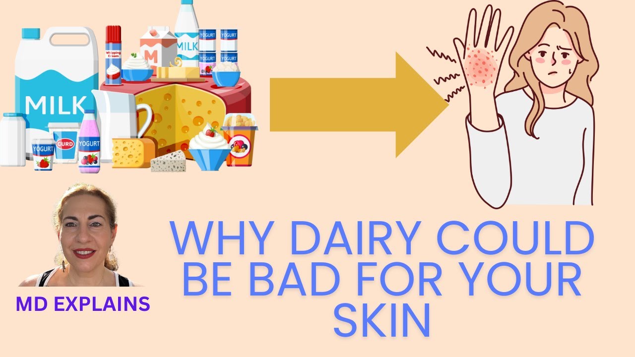 Is Dairy RUINING Your Skin? Dairy Sensitivity, Allergy, Lactose Intolerance EXPLAINED: PART 1