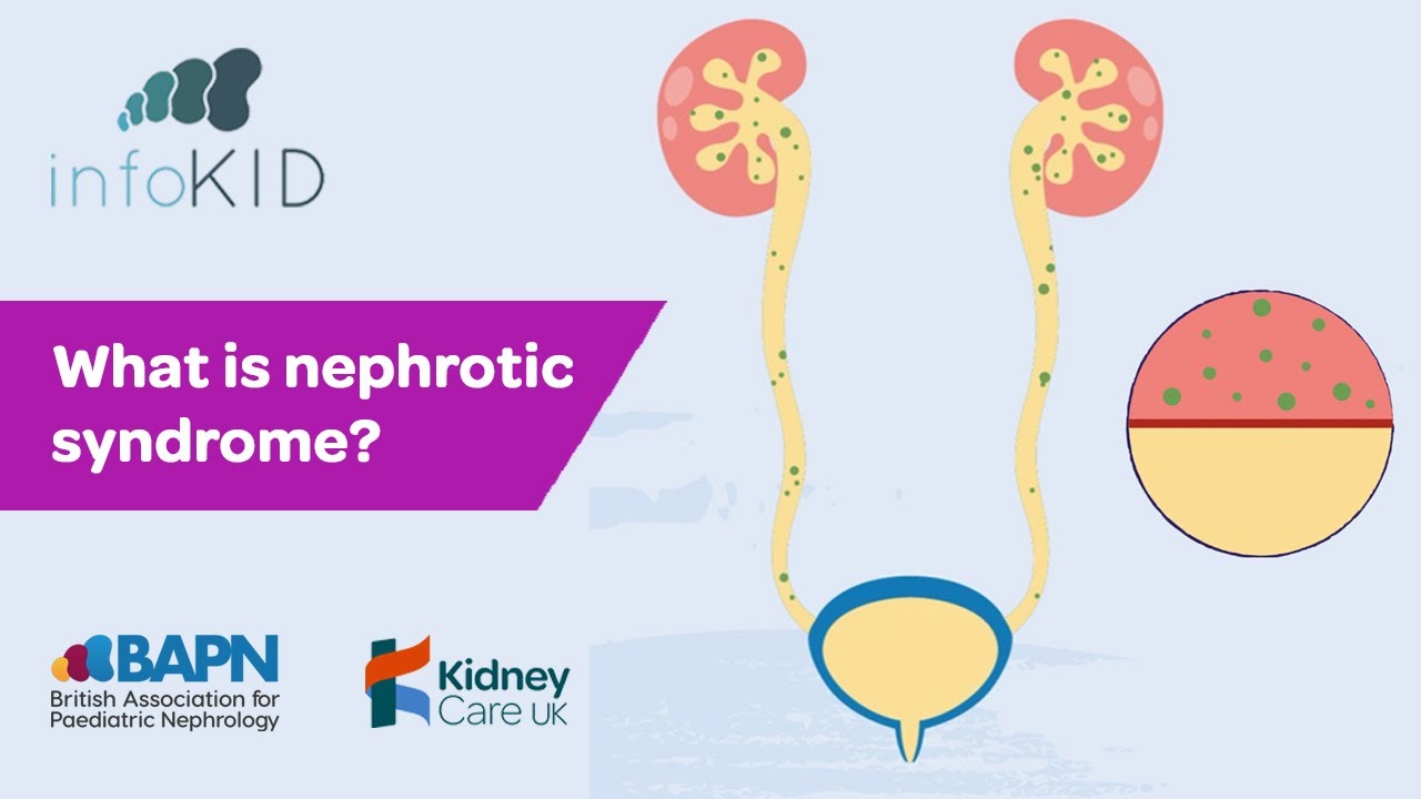 What is nephrotic syndrome? | Kidney disease | infoKID