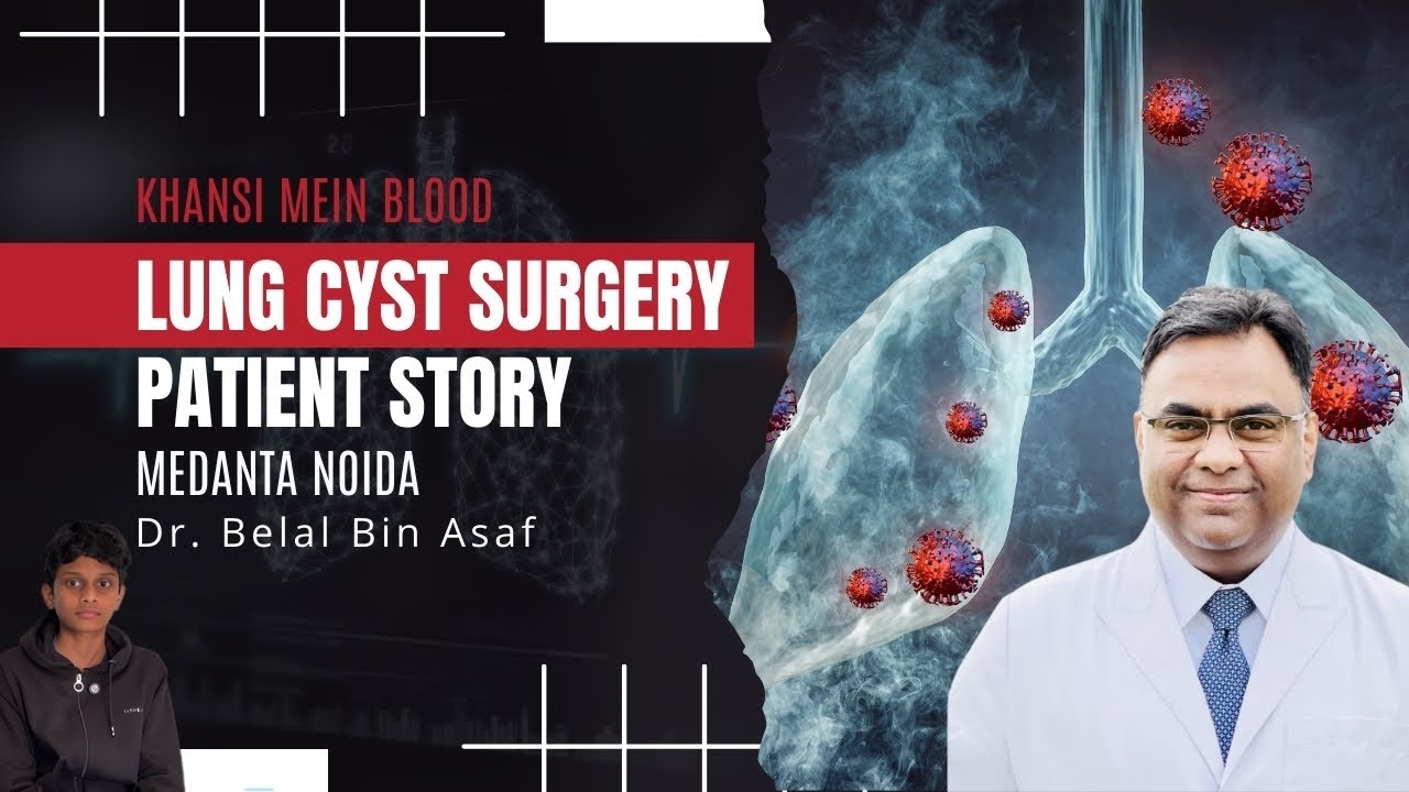 Khansi Mein Blood? | Lung Cyst Surgery Patient Story | Dr. Belal Bin Asaf | Medanta Noida