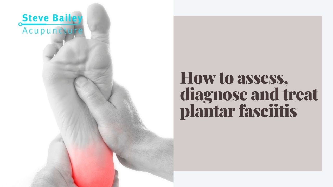 How to assess, diagnosis, and treat plantar fasciitis with dry needling and acupuncture.