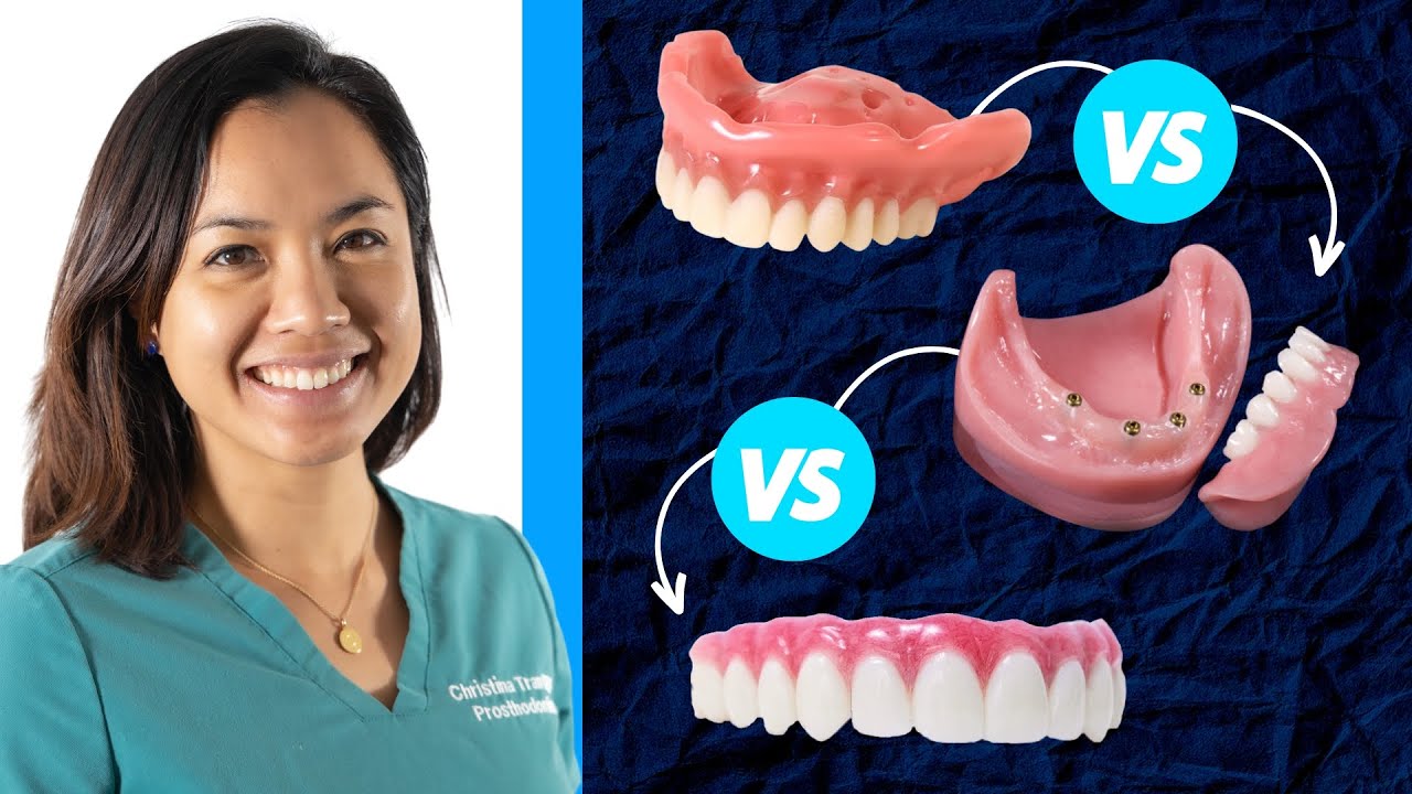 Dentures vs. Snap -in Dentures vs. ALL on 4 ®️ Bridge