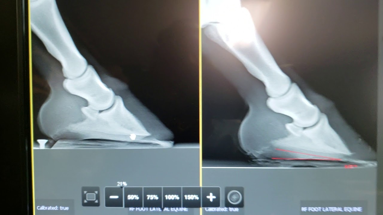 Pedal Osteitis Findings in a TB Gelding