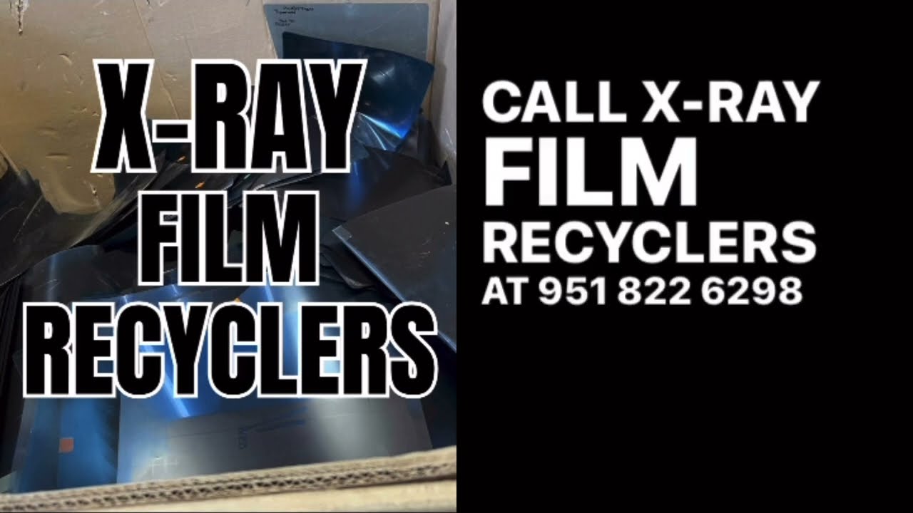 Who Buys X-Ray Films for Silver Recovery? | Get Cash & Stay HIPAA Compliant