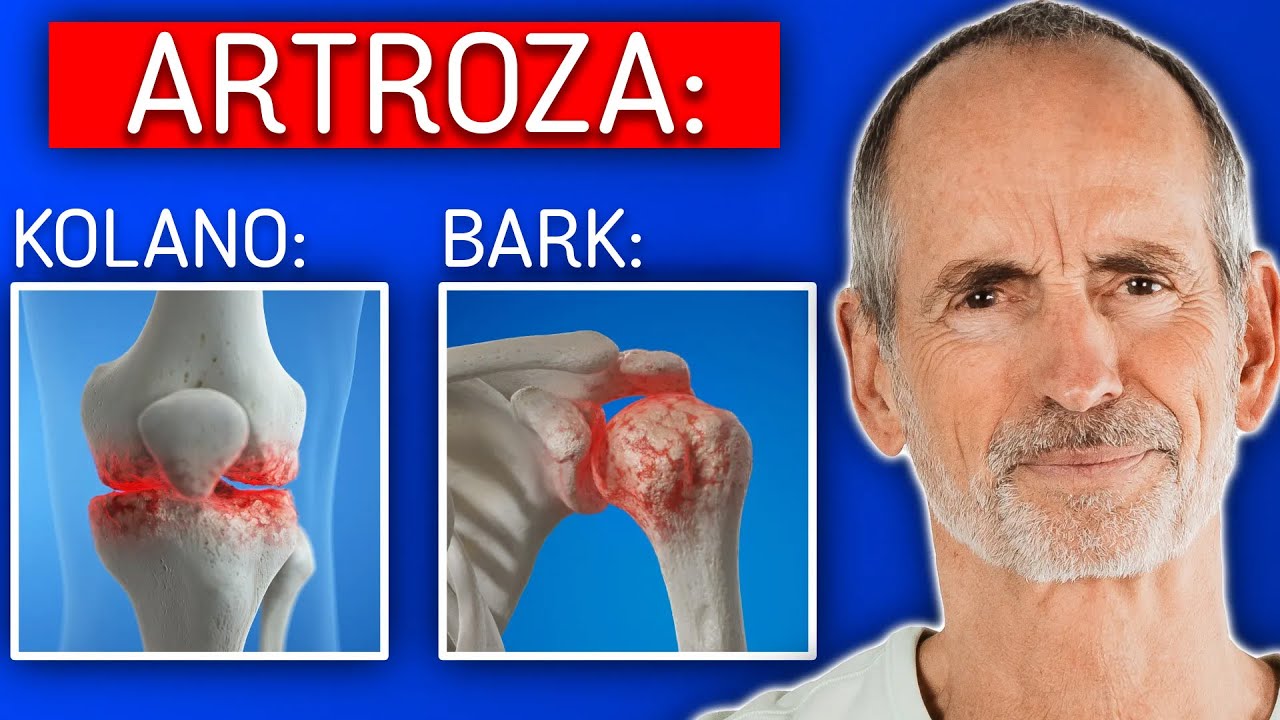 Nikt NIE MÓWI Ci TEGO o artrozie (Cała prawda o zwyrodnieniu stawów)