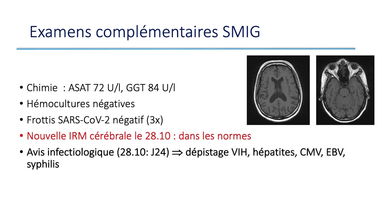 Une mycobact&eacute;ri&eacute;mie r&eacute;fractaire - Pre A. Calmy