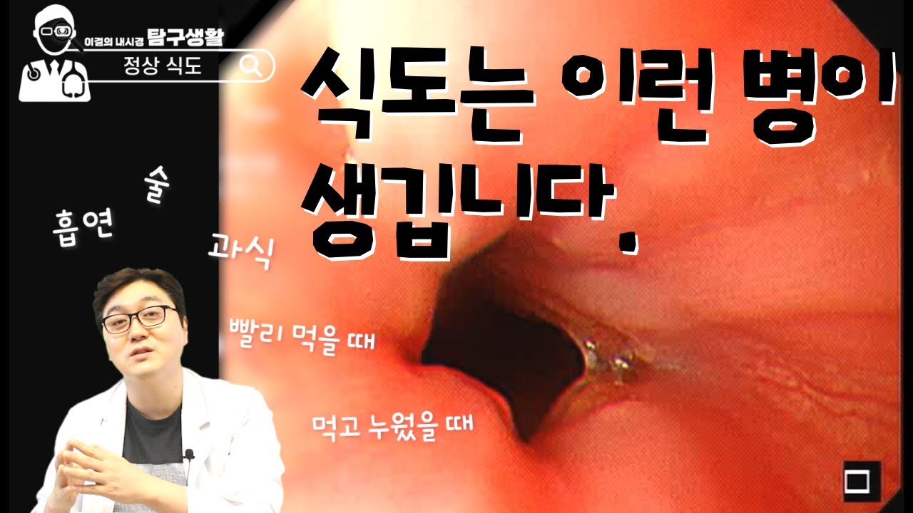 식도는 왜 아픈걸까? 내시경을 보면서 알아보자 l 내시경탐구생활