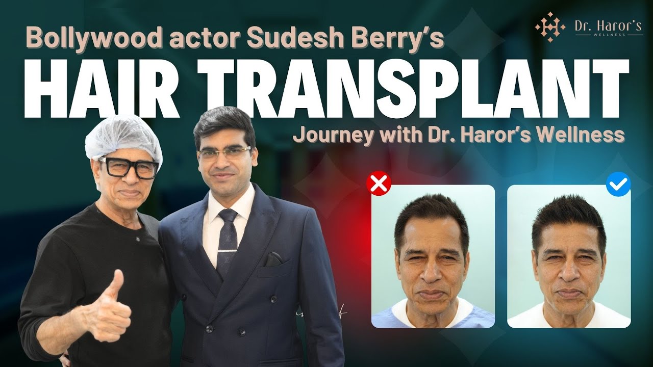 Bollywood Actor Sudesh Berry&rsquo;s Hair Transformation |Celebrity Hair Transplant| Dr. Haror&rsquo;s Wellness