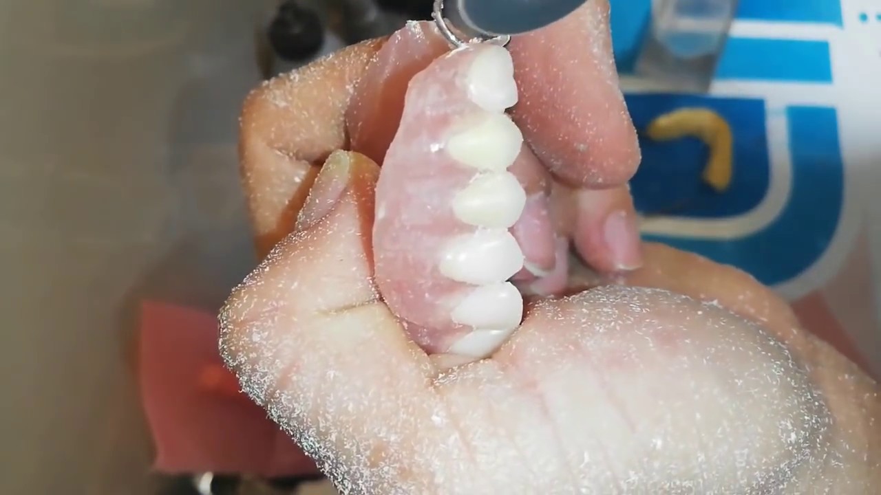 RECORTE PULIDO Y ACABADO FINAL PROTESIS DENTAL PARCIAL ACRILICA